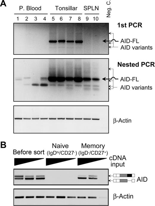 Figure 2. Expression of AID-splicing variants in normal B cells. (A) Expression of various transcripts of AID in B cells of peripheral blood, tonsils, and spleens of healthy donors. An agarose gel image of RT-PCR products (top panel), the nested PCR (middle panel), and β-actin PCR loading control (bottom panel) is shown. (B) An agarose gel image of AID-nested RT-PCR on RNAs isolated from FACS sorted pure naive and memory B cells. To ensure the PCR sensitivity, cDNA inputs with 3 different dilutions (1:1, 1:4, and 1:16) were used in PCR amplification.