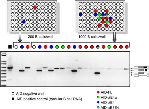 Figure 4. AID-splicing variants are singly expressed in individual tonsillar B cells. Purified human tonsillar B cells were limiting diluted into 96-well PCR plates at the densities of 200 cells/well and 1000 cells/well (depicted in top panels). The wells filled with various colors indicate where AID was positively detected, and the color codes show the identities of the AID PCR products. (Bottom panel) DNA gel image showing the amplified AID variants from those PCR-positive wells.