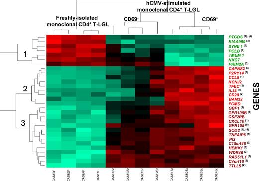 Figure 2. Hierarchical clustering analysis dendrogram of those 30 genes showing the highest differences between freshly isolated and both purified CD69+ and CD69− hCMV-stimulated monoclonal CD4+ T-LGL (n = 12 paired cell samples). The relative level of expression of each gene is represented by a color code where red represents an expression higher than the mean and green represents an expression below the mean values. Those genes showing different levels of expression in the distinct cell fractions analyzed are known to be involved in inflammatory (1) and immune (2) responses, cell proliferation and/or cell-cycle progression (3), apoptosis (4), protein synthesis (5), G-protein receptor-mediated cell signaling (6), and the DNA repair and maintenance machinery (7). Of note, both CD69+ and CD69− hCMV-stimulated monoclonal CD4+ T-LGLs showed a high similarity in their levels of expression for most of the genes displayed in the dendrogram, except for NKG7, PRIM2A, CAPNS2, P2RY14, CCL8, KCNJ2, TFEC, IL22, CD28, BAM32, and FCMD.