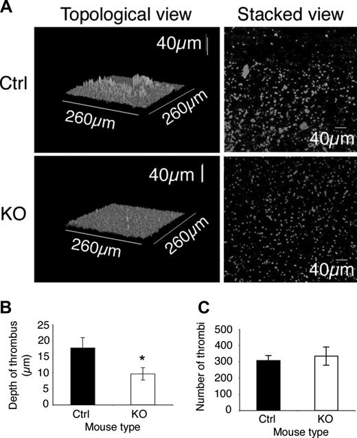 Figure 4. Thrombus formation is diminished in ILK-deficient blood. Whole blood from KO and control (Ctrl) mice was labeled with DiOC6 and perfused through a collagen-coated capillary at a shear rate of 1000 s−1. Representative topological and composite (stacked) views of the thrombi formed (A) show more large thrombi are formed in the control (Ctrl) compared with the KO, though the KO sample still shows formation of many small plaques. (B) The average maximum depth of thrombi formed in a field of view (mean ± SEM, n = 10; *P ≤ .05). The number of thrombi formed (C) was not significantly altered in the control and KO samples (mean ± SEM, n = 10; P = .34).