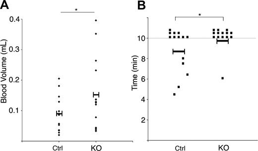 Figure 5. Bleeding time and volume is increased in the ILK KO mice. The time to cessation of bleeding following transection of the tail tip of ILK-deficient and litter-matched control (Ctrl) was measured over 10 minutes. Data represent individual mice (n = 14) with the mean value indicated. *P < .05 (A). The volume of blood lost was assessed and is represented for individuals. *P < .05 (B).