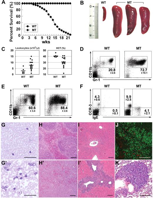 Figure 1. Mib1 conditional knockout mice develop an MPD. (A) Cumulative survival of MMTV-Cre;Mib1+/f (WT; n = 277) and MMTV-Cre;Mib1f/f (MT; n = 292) mice. (B) Splenomegaly in the 14-week-old MT mice (right) compared with an age-matched wild-type (WT) control (left). (C) Hemograms of 14- to 16-week-old WT (n = 6) and MT (n = 16) mice. Bars indicate the mean. (D-F) Flow cytometric analysis of peripheral blood leukocytes (PBLs) (D,F) and BM cells (E) from 12- to 16-week-old WT (left) and MT (right) mice. Numbers around rectangles indicate the mean plus or minus SD (n = 10). Note that marked eosinophilia with CCR-3+ and basophilia with IgE+ (F) are evident in the mutant mice. (G and G′) Giemsa staining of blood smears from the WT (G) and MT (G′) peripheral blood. (H,I′) Hematoxylin and eosin staining of the WT (H and I) and MT (H′,I′) spleens (H,H′) and livers (I,I′). (J) Myeloid peroxidase (MPO; in green) and proliferating cell nuclear antigen (PCNA; in red) double immunohistochemistry of the liver (×400) from 15-week-old MMTV-Cre;Mib1f/f mice. (K) Hematoxylin and eosin staining of MT lung (×200). Scale bars: 50 μm (G, G′, and J); 100 μm (H, H′, I, I′, and K).