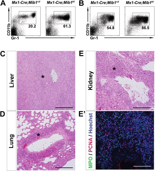 Figure 2. Mx1-Cre;Mib1f/f mice also develop an MPD. (A,B) Flow cytometric analysis of blood (A) and BM cells (B) from Mx1-Cre;Mib1+/f (left) and Mx1-Cre;Mib1f/f (right) mice 5 months after pIpC treatment (200 μg/every other day, 4 times). (C-E) Massive leukocyte infiltration (*) in the liver (C), lung (D), and kidney (E) (hematoxylin and eosin stain, ×200) of the Mx1-Cre;Mib1f/f mice. (E′) MPO/PCNA double immunostaining of the kidney (×200) from Mx1-Cre;Mib1f/f mice, 15 weeks after pIpC injection. Results are representative examples of 3 mutant mice. Scale bars: 100 μm.