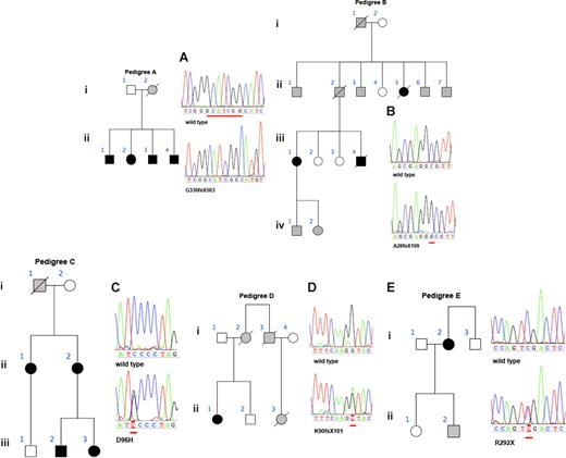 Figure 1. Pedigrees for the 5 FPD/AML families and their corresponding DNA sequencing traces for the mutated RUNX1 gene and the corresponding wild-type sequence. Within the pedigrees, squares represent males; circles, females; black boxes, confirmed RUNX1 mutations; dark gray boxes, history of MDS/AML; pale gray boxes, history of thrombocytopenia; unfilled boxes, unaffected patients. (A,B) Sequence traces representing the sequence analysis of the cloned mutated allele. (C-E) Direct from patient genomic DNA. (A) 7-bp deletion in exon 8; (B) 1-bp insertion in exon 3; (C) C→G missense mutation in exon 4; (D) splice donor site mutation in intron 3; (E) C→T nonsense mutation. The nucleotide numbers are relative to the start codon ATG defined as + 1 of the AML1b transcript (blast accession no. L34598) as previously reported.23