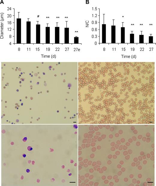 Figure 4. Enucleation of hESC-derived erythroid cells in vitro. (A) Diameter decreases with time in culture. Data for each day represent diameters of nucleated cells, except “27e” represents diameters of enucleated cells at 27 days. Enucleated cells decrease to less than half the original diameter on day 8. (B) Nuclear-to-cytoplasm ratio decreases with time in culture. Samples significantly different from day 8: *P < .05, **P < .001, #P < .002. (C,E) Erythroid cells derived from human ESCs were cultured in vitro for 4 weeks in Stemline II media with supplements and cocultured with OP9 stromal cells on day 36. On day 42, cells were cytospun and stained with Wright-Giemsa dye (C: original magnification ×200; E: original magnification ×1000). (D,F) Red blood cells from human blood were also cytospun and stained with Wright-Giemsa and compared with hESC-derived erythroid cells (D: original magnification ×200; F: original magnification ×1000). Scale bar represents 10 μm.
