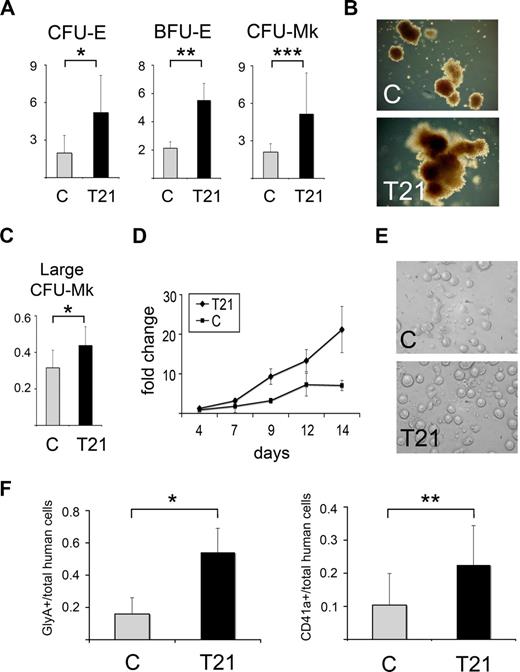 Figure 1. Increased erythroid and megakaryocytic potential of trisomy 21 fetal hematopoietic cells. (A) Methylcellulose colony assays of mononuclear cells (MNCs) from trisomy 21 (T21, n = 8) and control (C, n = 8) fetal livers. The numbers of burst-forming unit–erythroid (BFU-E) colonies are normalized to the numbers of colony-forming unit–granulocyte macrophage (CFU-GM) colonies obtained from the same culture dishes. The numbers of colony-forming unit–erythroid (CFU-E) and colony-forming unit–megakaryocyte (CFU-Mk) colonies are normalized to the numbers of CFU-GM obtained from the same number of cells plated in parallel GM cultures (y-axis, CFU-E, BFU-E, or CFU-Mk:CFU-GM ratio). CFU-Mk formation was assessed in semisolid cultures that were subsequently dehydrated, fixed, and stained with anti-GPIIb/IIIa antibody; CFU-Mk were scored based on GPIIb/IIIa positively staining cells. Colony assays were performed in triplicate. Results are shown as mean values plus or minus SD. *P = .014, **P < .005, ***P = .021. (B) Representative examples of BFU-E colony morphology from T21 and C fetal liver cells. T21 BFU-E colonies tended to be larger, with the majority approximately twice the size of control colonies. Original magnification, 10X. Photographs were taken using a Carl Zeiss Axiovert 25 microscope (Carl Zeiss, Thornwood, NY) equipped with a digital color camera (Canon Powershot A640; Canon, Lake Success, NY) and Axiovision acquisition software (Zeiss). (C) Large CFU-Mk, defined as more than 50 cells per colony, generated from T21 (n = 8) and C (n = 8) fetal liver MNCs. The y-axis shows the ratio of large CFU-Mk normalized to total CFU-Mk colonies generated by the same fetal liver specimen. Results are shown as mean values plus or minus SD. *P = .028. (D) Growth of megakaryocytes in liquid culture. T21 (n = 4) and C (n = 3) fetal liver MNCs were seeded into serum-free growth medium supplemented with thrombopoietin (Tpo). The y-axis shows relative numbers of megakaryocytes, as defined by expression of the lineage marker CD41a. By 14 days, approximately 90% of the cells expressed megakaryocyte markers CD41a and CD42 (not shown). Results are indicated as mean values plus or minus SD. (E) Representative examples of proplatelet formation in T21 and C fetal liver liquid megakaryocyte cultures on day 13. Proplatelet formation appeared on day 8 of culture and increased with each subsequent day in both T21 and C liquid cultures. By visual inspection, there were no differences in the extent of proplatelet formation between T21 and C samples. Original magnification, 20X. Photographs were taken using an Olympus IX70 microscope (Olympus, Center Valley, PA) equipped with a Photometrics Coolsnap camera (Photometrics, Pleasanton, CA) and Openlab version 5.5 acquisition software (Improvision, Waltham, MA). (F) Hematopoietic development of T21 (n = 11) and C (n = 12) fetal liver MNCs 5 to 10 weeks after transplantation into NOD/SCID/IL-2Rγcnull mice. Mice that received T21 MNCs exhibited an increased fraction of erythroid cells (Glycophorin A+, left panel) and megakaryocytes (CD41a+, right panel) within the human hematopoietic compartment in bone marrow of chimeric mice. Results are shown as the mean values plus or minus SD. *P < .005, **P = .007.