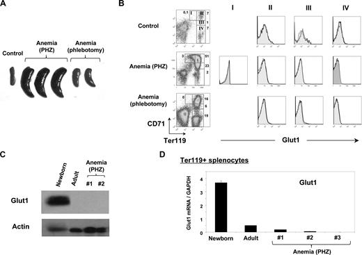 Figure 4. Induction of anemia in adult mice does not result in the expression of Glut1 on differentiating erythroblasts. (A) The spleen of an adult mouse (control) is shown in comparison with those obtained from mice wherein anemia was induced either by phenylhydrazine treatment or phlebotomy of 0.5 mL blood on days 0, 1, and 3. Spleens were obtained from killed mice at day 6 after treatment. (B) Erythroblast differentiation was assessed in freshly isolated splenocytes obtained from control adult mice; 6 days following induction of anemia as indicated, differentiation was assessed by staining with CD71 and Ter119 antibodies. The percentages of cells in each region (regions I to IV) are indicated in the respective dot plot. The relative expression of Glut1 in each of the 4 regions was determined by gating on the identified CD71/Ter119 populations. Shaded histograms show nonspecific staining. (C) Glut1 expression in peripheral red blood cells from newborn mice, adult mice, and adult mice rendered anemic by phenylhydrazine (PHZ) treatment (mice numbered 1 and 2) was assessed by immunoblotting using an anti-Glut1 pAb. Protein loading was monitored by immunoblotting for actin. (D) Glut1 transcripts were assessed in Ter119+ splenic erythroid progenitors isolated from newborn, adult, and PHZ-treated anemic mice (numbered 4 to 6; day 6), as indicated, by qRT-PCR. cDNAs were amplified with primers specific for Glut1 and means plus SD of duplicate samples normalized to GAPDH are shown.