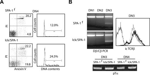 Figure 2. Enhanced apoptosis in situ of the DN4 cells from lck/SPA-1 Tg mice. (A) DN4 thymocytes isolated from lck/SPA-1 Tg and SPA-1flox Tg littermate mice were immediately 2-color stained with PI and annexin V (left), or fixed and stained for DNA with PI (right). (B) Subsets of DN thymocytes were sorted from lck/SPA-1 Tg and littermate control mice, and genomic PCR was done with the use of TCR Dβ and Jβ primers (top left). The DN3 cells were fixed, permealized and stained with anti-TCRβ antibody (top right). Solid line indicates lck/SPA-1Tg; dotted line, SPA-1flox Tg mice; and fine line, staining with control antibody. RNAs were extracted from DN3 and DN4 cells, and RT-PCR was done with the use of pTα primers (bottom).