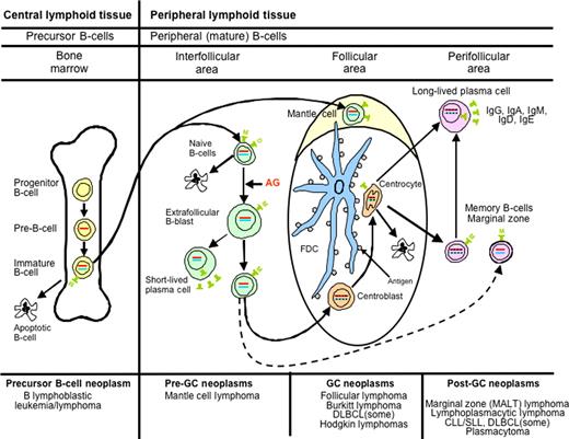 Figure 2. Diagrammatic representation of B-cell differentiation and relationship to major B-cell neoplasms. B-cell neoplasms correspond to stages of B-cell maturation, even though the precise cell counterparts are not known in all instances. Precursor B cells that mature in the bone marrow may undergo apoptosis or develop into mature naive B cells that, following exposure to antigen and blast transformation, may develop into short-lived plasma cells or enter the germinal center (GC), where somatic hypermutation and heavy chain class-switching occur. Centroblasts, the transformed cells of the GC, either undergo apoptosis or develop into centrocytes. Post-GC cells include both long-lived plasma cells and memory/marginal zone B cells. Most B cells are activated within the GC, but T cell–independent activation can take place outside of the GC and also probably leads to memory-type B cells. Monocytoid B cells, many of which lack somatic hypermutation, are not illustrated. AG indicates antigen; and FDC, folllicular dendritic cell. Red bar represents immunoglobulin heavy chain gene (IGH@) rearrangement; blue bar, immunoglobulin light chain gene (IGL) rearrangement; and black insertions in the red and blue bars indicate somatic hypermutation.