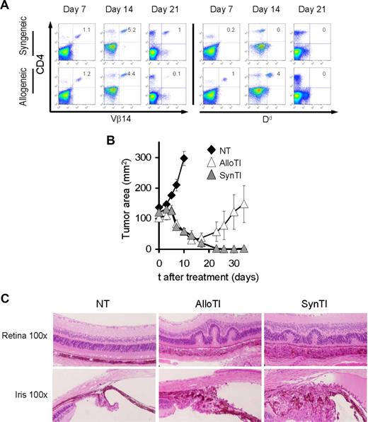 Figure 4. Allogeneic tumor-specific CD4+ cells cause tumor regression and ocular autoimmunity in lethally irradiated hosts. C57BL/6 mice bearing B16 tumors established for 12 days were irradiated with 9 Gy TBI. Mice were left untreated as a control (NT) or injected on day 0 with 106 allogeneic TRP-1b/d cells and exogenous IL-2 (AlloTI) or 106 syngeneic TRP-1b/b cells and exogenous IL-2 (SynTI). All groups received syngeneic BMT with 106 unsorted bone marrow cells the day after the transfer of the effector cells. (A) Spleens analyzed for the presence of transferred T cells at the indicated time points. The experiment was independently repeated with similar results. (B) B16 tumor growth in the different treatment groups. Results of tumor area are the mean of measurements of at least 5 mice per group (± SEM) (n = 5, 9, and 10 mice for NT, AlloTI, and SynTI, respectively, in the experiment shown). Data are representative of 3 independent experiments. (C) Hematoxylin and eosin staining of ocular tissue of mice killed at day 14. Images were obtained using a Nikon Eclipse E400 microscope equipped with Nuance Multispectral Imaging System VIS (original magnification ×100). Images were processed using Adobe Photoshop, version 7, as described in “Histology.”