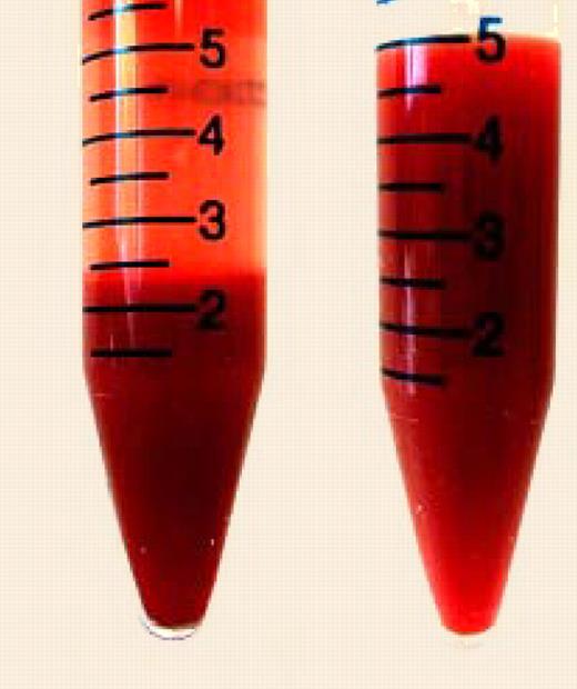 In vitro produced human embryonic stem cell-derived red blood cells. See the complete figure in the article beginning on page 4475.