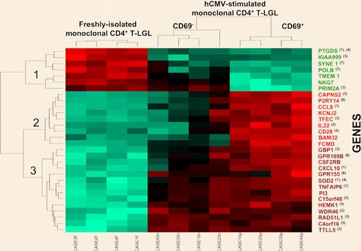 Hierarchical clustering analysis dendrogram of those 30 genes showing the highest differences between freshly isolated and both purified CD69+ and CD69− hCMV-stimulated monoclonal CD4+ T-LGL (n = 12 paired cell samples). The relative level of expression of each gene is represented by a color code where red represents an expression higher than the mean and green represents an expression lower than the mean values. Those genes showing different levels of expression in the distinct cell fractions analyzed are known to be involved in inflammatory (1) and immune (2) responses, cell proliferation and/or cell-cycle progression (3), apoptosis (4), protein synthesis (5), G-protein receptor-mediated cell signaling (6), and the DNA repair and maintenance machinery (7). Of note, both CD69+ and CD69− hCMV-stimulated monoclonal CD4+ T-LGLs showed a high similarity in their levels of expression for most of the genes displayed in the dendrogram, except for NKG7, PRIM2A, CAPNS2, P2RY14, CCL8, KCNJ2, TFEC, IL22, CD28, BAM32, and FCMD. See the complete figure in the article beginning on page 4609.