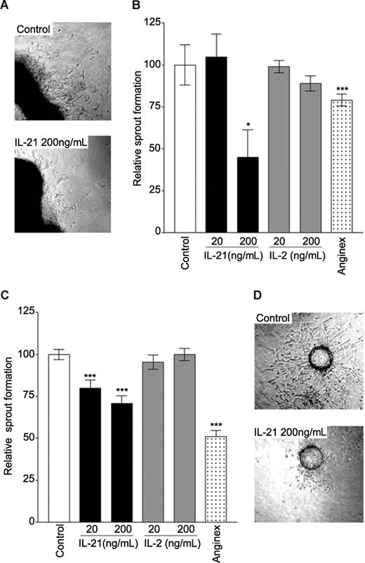 Figure 1. IL-21 inhibits angiogenic sprouting of endothelial cells. (A) A mouse aortic ring treated with bFGF (10 ng/mL) and bFGF and IL-21 200 ng/mL. (B) Quantification of sprouting of primary mouse endothelial cells from isolated aortic rings in a three-dimensional collagen matrix. (C) Sprouting of bFGF (10 ng/mL) stimulated SVEC4-10 cells (mouse endothelial cell line) grown on beads embedded in a three-dimensional collagen matrix. (D) An example of sprouting of SVEC4-10 cells treated with bFGF (10 ng/mL, top panel) and bFGF and IL-21 (bottom panel). Data are relative mean values of at least 3 experiments (***P < .0005, *P < .05, compared with control).