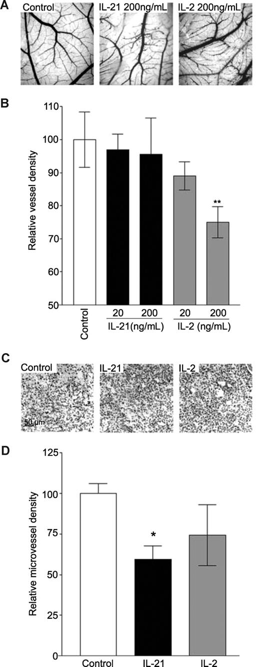 Figure 4. IL-21 and IL-2 inhibit angiogenesis in vivo. (A,B) Treatment of CAMs with 200 ng/mL IL-2 reduces vessel formation in CAMs, whereas IL-21 does not affect the number of vessels in CAMs (n = 7 for each group). Morphologic examination shows that vessels in CAMs treated with 20 ng/mL or 200 ng/mL IL-21 are tortuous and irregular compared with control CAMs (B). (C) Images of CD31 staining of EF7 tumor sections of mice treated with PBS (control), 20 μg of IL-21, or 2000 IU of IL-2 (images seen through a Leica DM5000B microscope, Leica Microsystems, Rijswijk, The Netherlands). (D) IL-2 (n = 4) and IL-21 (n = 5) treatment reduced microvessel density in tumor tissues compared with control (PBS, n = 5). Results are relative mean values (**P < .005, *P < .05, compared with control).