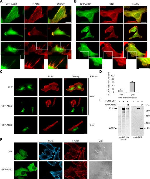 Figure 1. ASB2 induces FLNa degradation. GFP-tagged ASB2 colocalizes with F-actin (A) and FLNa (B) in stress fibers (top), lamellae (middle), and filopodiae (bottom). HeLa cells were imaged 10 hours after transfection with GFP-ASB2 expression vector. Actin was detected with Alexa 568-phalloidin and FLNa with an antibody against its N terminus. Higher magnification views of the lower panels are also shown (bottom). (C) HeLa cells were transfected with GFP or GFP-ASB2 expression vectors as indicated; 24 hours later, FLNa was localized by staining the cells with antibodies directed against the N terminus (N-ter) or C terminus (C-ter) of the protein. Scale bars represent 20 μm. (D) FLNa-negative, GFP-ASB2-positive HeLa cells were counted 10 and 24 hours after transfection among a randomly selected pool of at least 100 cells expressing GFP-ASB2. Results are mean plus or minus SEM from 3 independent experiments. (E) NIH3T3 cells were mock-transfected or transfected with FLNa-GFP and GFP-ASB2 expression vectors for 24 hours, as indicated; 20-μg aliquots of whole cell extracts were immunoblotted with antibodies directed against the N-ter of human FLNa and GFP. Antibodies to human FLNa do not recognize endogenous mouse FLNa. (F) Triple staining showing F-actin organization and FLNa expression in HeLa cells expressing GFP or GFP-ASB2.