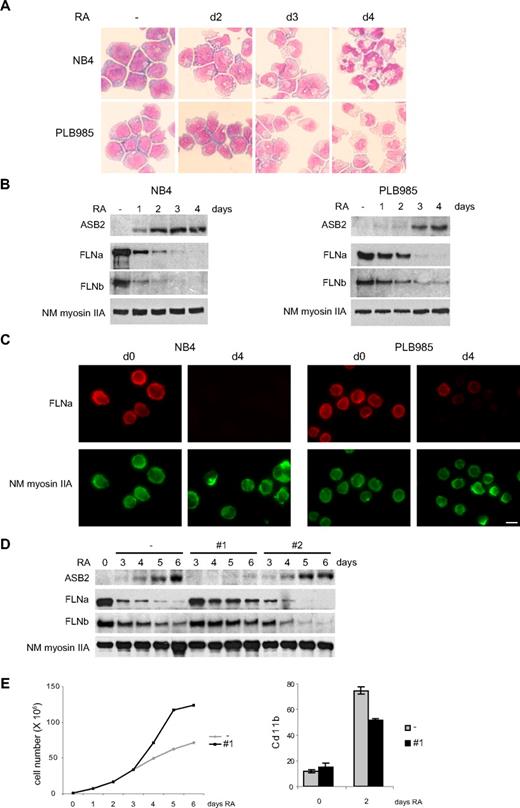 Figure 5. ASB2 induces degradation of FLNa and FLNb in differentiating myeloid leukemia cells. (A-C) Down-regulation of FLNa and FLNb in myeloid leukemia cells induced to differentiate correlates with ASB2 induction. NB4 and PLB985 cells were treated with 10−6 M of all-trans RA. Differentiation was assessed by cell morphology on May-Grünwald-Giemsa-stained cytospin slides (A). Expression of ASB2, FLNa, FLNb, and non-muscle myosin IIA (NM myosin IIA) was analyzed by Western blot using 20-μg aliquots of whole cell extracts (B) and by immunofluorescence (C). (D) ASB2 knockdown delayed RA-induced FLNa and FLNb degradation. Stable PLB985 cell populations expressing shRNAs directed against ASB2 (no. 1 and no. 2) or transfected with the empty vector (−) were treated with 10−6 M RA for different times as indicated; 10-μg aliquots of the protein extracts were analyzed by Western blotting. (E) PLB985 cell populations expressing shRNA no. 1 or transfected with the empty vector (−) were untreated and treated with RA. (Top panel) Representative experiment of 3 showing numbers of viable cells. (Bottom panel) Percentages of CD11b-positive cells. Error bars represent SDs from the results of 3 independent experiments.