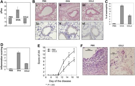 Figure 5. CCL2 mediates an anti-inflammatory role in vivo. (A) Asthma model: control (PBS-treated), OVA-primed mice (OVA), and OVA-primed mice injected intraperitoneally with 60 ng of CCL2 (CCL2) as described in “Methods” were analyzed for airway responsiveness on day 19. Values shown represent Δ Penn, which was calculated by subtracting control Penn measurements before antigen challenge from the Penn measurements after late or early antigen challenge. Baseline Penn levels were comparable among PBS-treated control, OVA-primed mice, and OVA-primed mice treated with CCL2. The results represent an average of 9 animals per treatment. (Bi-iii) Lung histology in mice that received CCL2 treatment. Histologic features of representative control (PBS), OVA-primed (OVA), and OVA-primed treated with low-dose CCL2 (CCL2) animals are shown. (Biv-vi) Immunohistochemical staining of the T cells in lung sections. (C) Bronchoalveolar lavage cell recovery in mice after treatment with CCL2. Percentage eosinophil recovery in BAL fluids in the various mice. Values represent the mean of 5 animals. (D) The peribronchial and perivascular inflammatory infiltrates were given an inflammatory score between 1 and 4 by a pathologist. The graph represents the average scores of 9 animals from each treatment group. (E,F) Arthritis model: AA was induced as described in “Rodent model for rheumatoid arthritis induction and assessment,” and rats immediately divided into 2 groups that were injected with low-dose CCL2 (240 ng in 300 μL PBS) or PBS. (E) A disease score between 0 and 4 was assigned to each limb, based on the degree of joint inflammation, redness, and deformity; the maximum possible score for an individual animal was 16. The graph represents the scores of 9 animals in each group that were measured every day. (F) Joint histology in PBS- or CCL2-treated mice. Results are presented as the mean plus or minus SEM of the difference between the 2 values for all the animals in each group. All photomicrograph images (B,F) were obtained with an Olympus AK 70 microscope (Center Valley, PA), Olympus Ach 20×/0.4 ∞/0.17. Camera make and model: Nikon Digital Camera DXM 1200F. Name and version number of image-acquisition software: Nikon ACT-l for DMX1200F.