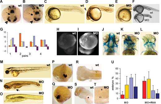 Figure 2. Phenotype of rps19-deficient embryos. (A,B) Forebrain () and eye field (▶) are reduced in morphants. In situ hybridization, pax2a probe, 16 hpf. In situ hybridization was performed on 30 morphant or wild-type embryos. (C,D) At 24 hpf, morphants have small head and eyes, pinched midbrain-hindbrain boundary, and necrotic regions in brain (). A typical morphant embryo is shown. (E) In some morphants, forebrain and eyes are absent. The frequency of this phenotype was 0% to 5%. (F) rps19-deficient embryos are smaller than wild-type. (G) Phenotypic manifestations of rps19 deficiency vary between the progeny of different pairs. Red represents normal looking; yellow, mild malformations; blue, strong malformations; purple, forebrain and eyes are absent; violet, dead. Twenty-five healthy looking morphants from each pair were selected at 6 hpf and compared at 20 hpf. Progeny of 4 pairs are shown as an example. (H,I) The level of apoptosis is higher in morphants. Acridine orange staining, 1 μg/mL, 30 minutes, 20 hpf. A representative embryo from at least 30 is shown. (J-L) Cartilage of the head is malformed in morphants. Alcian blue, 120 hpf. (M-O) The morphant fish shown in panel N has edema (); eyes are present but abnormal. The fish shown in panel O has no eyes and forebrain. Note an abnormally large ventral fin in this fish, 120 hpf. (P,Q) Heart field's position and orientation are reversed in some morphants. In situ hybridization, lft2 probe, 19 hpf. An embryo representative of the group of 30 embryos used for in situ hybridization is shown. (R-T) Position of visceral organs is also randomized in morphants. Pancreas is located on the right side in wild-type fish (R), whereas in some morphants it is on the left (S) or bilateral. (T) 120 hpf, insulin probe. (U) rps19-deficient embryos are rescued by injection of 200 pg of rps19 mRNA. The proportion of normal-looking embryos among RPS19-deficient morphants is higher in the group injected with the RNA; the proportion of embryos with severe defects is reduced as is the death rate. No effect was observed after injection of GFP mRNA: 48 hpf, 3.4 ng MOs/embryo. Red represents morphologically normal embryos; yellow, mild defects; blue, severe defects; black, death. Eighty embryos were used per group. Shown are the results representative of 3 independent experiments.