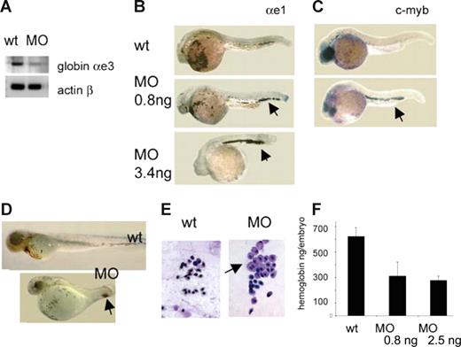 Figure 3. RPS19-deficient embryos have defects in erythropoiesis. (A) RT-PCR, red blood progenitors sorted out from embryos at 19 to 20 hpf. Globin expression is lower in morphants. The cells were purified from a pool of 300 embryos. (B) The differentiation of erythroid cells is delayed in morphants: at 30 hpf almost all erythroid cells are still in ICM region in morphants. In situ hybridization, globin αe1 probe, 30 hpf, 30 embryos per group. (C) Expression of c-myb in the tail regions in morphants () points to immaturity of red blood cells in these embryos. In situ hybridization, 30 hpf. (D) At 72 hpf, there are fewer blood cells in morphants; they are localized mostly in the posterior of the embryo (), and there are only few cells in the heart region: 2.5 ng morpholino per embryo, O-dianizidine staining, 30 embryos per group. (E) Erythroid cells from the blood of a morphant embryo are variable in size; some look like erythroblasts (). Zebrafish erythrocytes differ from mammalian cells in that both primitive and definitive cells are nucleated. Blood smears were prepared from individual embryos; the results are representative of 6 to 10 embryos. (F) The level of hemoglobin is lower in morphants at day 5 in dependence with morpholino dose. Hemoglobin levels were measured in pools of 80 embryos in triplicates. Five-day-old embryos (wild-type, morphants, or cloche mutants, which have no blood cells) were homogenized in 500 μL of Drabkin reagent (Sigma-Aldrich, St Louis, MO), incubated for 1 hour at room temperature, centrifuged 10 minutes at 16 000g, and the absorbance of supernatants was measured at 540 nm. Absorbance of cloche mutants was subtracted from the wild-type and morphant samples. In this way, only the absorbance derived from red blood cells was taken into consideration. It was plotted on a calibration curve obtained from a standard sample with known concentration of hemoglobin (Drew Scientific, Dallas, TX), and the amount of hemoglobin per embryo was calculated.