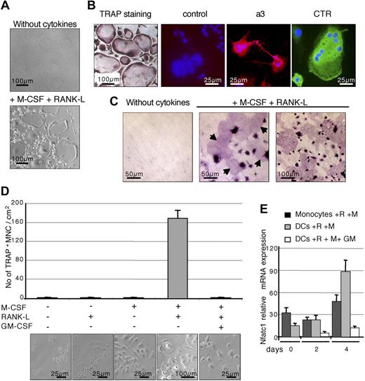 Figure 2. Differentiation of CD11c+ splenic DCs into functional OCLs in vitro. (A) Splenic DCs sorted from normal mice were cultured for 8 days either without cytokines or with 25 ng/mL M-CSF and 30 ng/mL RANK-L allowing their differentiation into multinucleated cells. (B) These differentiated cells were analyzed for their TRAP activity. The presence of the a3 protein (rhodamine) and the calcitonin receptor (fluorescein isothiocyanate) was also analyzed by immunofluorescence. Incubation with a preimmune serum served as negative control. Nuclei were stained with DAPI. (C) Resorption activity was assessed on dentine slices for cells cultured without cytokines or with M-CSF and RANK-L. Arrows indicate the presence of resorption lacunae with cytokine-treated cells. Equivalent results were found with DCs sorted from Balb/c and C57BL/6 mice. (D) Sorted splenic DCs were cultured for 8 days without cytokines or with various combinations of M-CSF (25 ng/mL), RANK-L (30 ng/mL), and GM-CSF (10 ng/mL). TRAP activity was analyzed and TRAP+ multinucleated cells (MNCs) were counted. The results are the mean plus or minus SD of 4 equivalent wells. (E) The kinetics of Nfatc1 expression was analyzed by real-time RT-PCR between days 0 and 4 of culture on cells treated with M-CSF (M) and RANK-L (R) and with our without GM-CSF (GM). The results are the mean plus or minus SD of 4 equivalent wells. All results are representative of 3 independent experiments. Images were captured using (panels A,D) an Axiovert 200 microscope (Carl Zeiss, Oberkochen, Germany) with a 10×/0.25 Ph1 or a 20×/0.3 Ph1 Var1 Plan objective (Carl Zeiss) and a JVC KY-F50 camera, (panel B) an Axioskop microscope (Carl Zeiss) with a 40×/1.30 oil objective (Carl Zeiss), an AxioCam HRc camera (Carl Zeiss), and Gel/Mount medium (Biomeda, Foster City, CA), and (panel C) an Axioskop microscope (Zeiss) with 20×/0.75 Fluar or 40×/0.75 Plan-Neofluar objectives. All images were acquired using AxioVision 4.5 software (Zeiss).