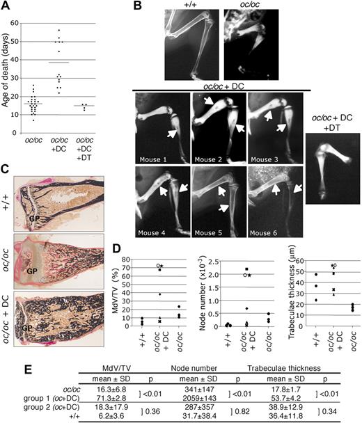 Figure 3. Partial reversion of the osteopetrotic phenotype in DC-treated oc/oc mice. (A) Distribution of the age of death of control oc/oc (n = 26), DC-treated oc/oc mice from 3 independent experiments (n = 14) and oc/oc treated with DCs purified from CD11c-DTR mice and diphtheria toxin (DT) (n = 4). (B) Radiographic analysis of normal mice, PBS-treated oc/oc mice, DC-treated oc/oc mice that survived more than 33 days (n = 6), and oc/oc mice treated with DCs from CD11c-DTR mice and DT. Arrows indicate the medullar cavity. (C) Histologic analysis of the tibia of normal littermates, control, and DC-treated oc/oc mice after van Gieson and von Kossa staining. GP indicates growth plate. The results are representative of the mean phenotype observed in 3 independent experiments. Images were captured using a DMLB microscope (Leica, Wetzlar, Germany), a 3CCD color video DXC-390 camera (Sony, Heerlen, The Netherlands) and the Osteomeasure Analysis System (Osteometrics, Atlanta, GA). (D) Bone morphometric analysis on +/+ mice (n = 3), PBS-treated oc/oc mice (n = 3), and DC-treated oc/oc mice (n = 6). The results are the distribution of the values measured for each animal. MdV/TV indicates mineralized volume/tissue volume. Correspondence with the radiographic analysis (C): ★ represents mouse 1; ■, mouse 2; ○, mouse 3; ♦, mouse 4; X, mouse 5; and ▲, mouse 6. (E) Statistical analysis of parameters from panel D. Parameters from control oc/oc mice were significantly different from those of DC-treated oc/oc mice group 1 (mice nos. 1-3) presenting a small bone marrow cavity (P < .01). A second group of DC-treated oc/oc mice, group 2 (mice nos. 4-6), presented a larger bone marrow cavity, and their histomorphometric parameters were not significantly different from normal +/+ mice (P > .05).