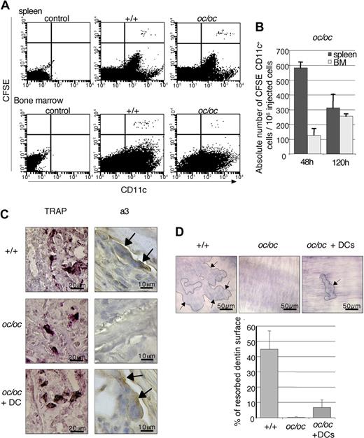 Figure 4. Presence of active OCLs in DC-treated oc/oc mice. (A) Distribution of CFSE-labeled CD11c+ cDCs was analyzed by flow cytometry 48 hours after intraperitoneal injection into +/+ and oc/oc mice. (B) The absolute number of CFSE+CD11c+ DCs in the spleen and bone marrow (BM) of oc/oc mice was calculated by multiplication of the percentage of CFSE+CD11c+ DCs by the total number of resident leukocytes. Data are the mean plus or minus SD of the number of recovered CFSE+CD11c+ DCs per 106 injected cells (n = 4 to 6 per group) and are representative of 2 independent experiments. (C) Representative histologic analysis of the femora of +/+ mice, control, and DC-injected oc/oc mice. TRAP+ cells were detected in all mice, but a3-expressing cells were detected in +/+ and DC-treated oc/oc mice but not in control oc/oc mice. (D) Bone marrow cells from +/+ mice, control, and DC-treated oc/oc mice were cultured onto dentine slices, and their bone resorption activity was analyzed. Resorption lacunae (arrows) were detected in +/+ and DC-treated oc/oc mice but not in control oc/oc mice. Images were captured using an Axioskop microscope (Carl Zeiss) with a 20×/0.75 Fluar objective (Carl Zeiss), an AxioCam HRc camera (Carl Zeiss), and AxioVision 4.5 software (Zeiss).