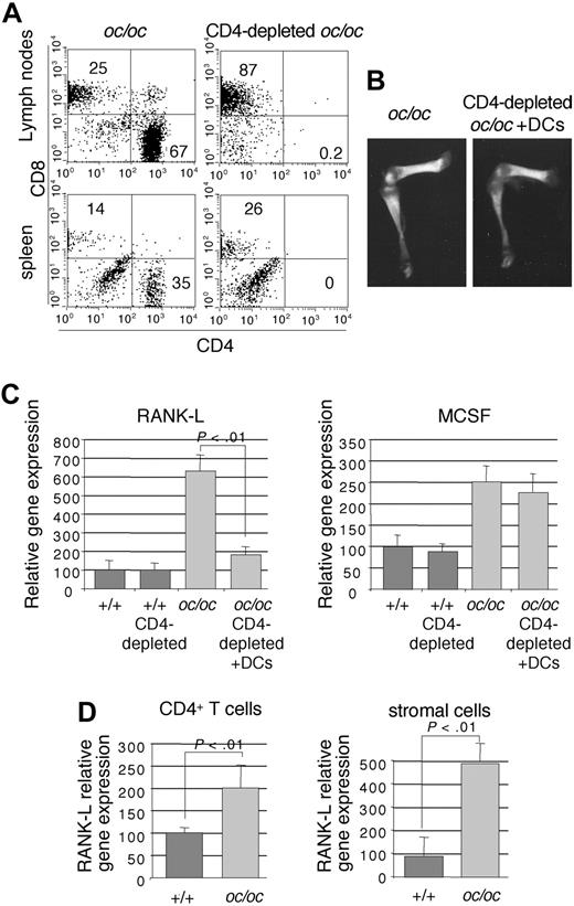Figure 5. CD4+ T cells are required for the DC-to-OCL differentiation in oc/oc mice. (A) Flow cytometric analysis of the mesenteric lymph nodes and the spleen of control oc/oc mice and CD4-depleted and DC-injected oc/oc mice. (B) Representative radiography of the femur and tibia of control oc/oc mice and CD4-depleted and DC-injected oc/oc mice. (C) The expression of Rank-l and M-csf was analyzed by real-time RT-PCR in the bone marrow of normal mice, control oc/oc mice, and CD4-depleted and DC-injected oc/oc. The results are the mean plus or minus SD of 3 or 4 mice in each group. All results are representative of 2 independent experiments. (D) Real-time RT-PCR analysis of CD4+ T cells or stromal cells purified from the bone marrow of +/+ and oc/oc mice. The results are the mean plus or minus SD of 6 or 7 mice in each group.