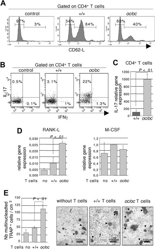Figure 6. Inflammatory CD4+ T cells from oc/oc mice are responsible for a high RANK-L expression and an increased osteoclastogenesis. (A) Flow cytometric analysis of splenic CD4+ T cells from oc/oc and +/+ mice using the activation marker CD62L. An isotype control (control) is presented. The results are representative of at least 5 oc/oc and 5 +/+ mice. (B) Intracytoplasmic analysis of IL-17 and IFN-γ production by flow cytometry on CD3+ T cells purified from the bone marrow. Nonactivated T cells served as control. Data are gated on pooled CD4+ cells from 4 or 5 oc/oc or +/+ mice. All results are representative of 3 independent experiments. (C) Real-time RT-PCR analysis of CD4+ T cells purified from the bone marrow of +/+ and oc/oc mice. The results are the mean plus or minus SD of 5 mice in each group. (D) Osteoblasts from +/+ mice were cultivated alone or in the presence of CD4+ T cells purified from the bone marrow of +/+ and oc/oc mice. Expression of Rank-l and M-csf was analyzed in the osteoblasts by real-time RT-PCR. The results are the mean plus or minus SD of 3 wells and are representative of 3 independent experiments. (E) Osteoclasts were generated by coculture of DCs with osteoblasts from +/+ mice and with our without CD4+ T cells purified from the bone marrow of +/+ and oc/oc mice. A representative result is presented, and multinucleated TRAP+ osteoclasts (arrow) were enumerated. The results are the mean of 8 wells and are representative of 3 independent experiments. Images were captured using an Axiovert 200 microscope (Carl Zeiss) with a 10×/0.25 Ph1 Plan objective (Carl Zeiss), a JVC KY-F50 camera, and AxioVision 4.5 software (Zeiss).