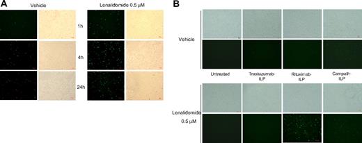 Figure 3. Lenalidomide enhances intracellular delivery of oligonucleotides in anti-CD20 immunoliposomes. (A) B CLL cells were incubated with rituximab-coated immunoliposomal FAM-ODN for 1 hour at 37°C. Cells were washed and incubated with lenalidomide for 1, 4, and 24 hours. At the end of the incubation time, cells were washed 3 times and visualized on a Nikon fluorescence microscope (original magnification, ×200). (B) Lenalidomide-enhanced delivery of oligonucleotides requires CD20 antigen binding and internalization. CLL cells were incubated with rituximab-, trastuzumab-, or alemtuzumab-coated immunoliposomal FAM-ODN for 1 hour at 37°C. Cells were washed and incubated with lenalidomide for an additional 24 hours. At the end of the incubation time, cells were washed 3 times and visualized on a Nikon fluorescence microscope (original magnification, ×200).