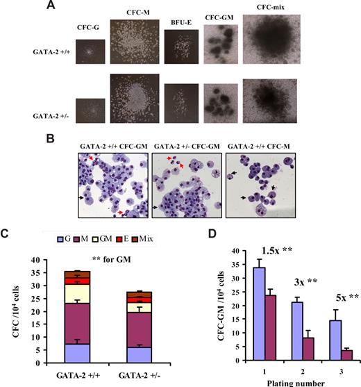 Figure 1. Attenuated formation and self-renewal capacity of granulocyte-macrophage progenitors from GATA-2+/− bone marrow. Bone marrow–nucleated cells from each genotype were plated in colony-forming medium supplemented with myeloid and erythroid growth factors and were assessed for granulocyte (CFC-G), macrophage (CFC-M), granulocyte-macrophage (CFC-GM), erythroid (E), and mixed (CFC-mix) colony formation. Three replicates were used per genotype in each experiment. Individual colony types were tallied on day 10. Representative colony types are depicted (A). May-Grünwald-Giemsa staining was used to confirm the lineage identity of individual colonies; typical morphologies of CFC-M and CFC-GM colonies from each genotype are depicted (B) (magnification ×40). Red arrows show the G lineage, and black arrows depict the M lineage. (A,B) The images were captured by the Axiovert 25 microscope (10× objective lens and a 4× eye piece; Zeiss, Welwyn Garden City, United Kingdom) using Immersol 518N mounting medium (Zeiss), May-Grünwald (Sigma, Dorset, United Kingdom) and Giemsa (Sigma) stains, a QIcam camera (QImaging, Pleasanton, CA), and Open Lab software (version 5.5; Coventry, United Kingdom). The cumulative score of specific lineages is shown (C) (n = 4; P = .01 for CFC-GM; CFC-G, P = .37; CFC-M, P = .08; BFU-E, P = .17; and CFC-mix, P = .43). To test the in vitro self-renewal potential of CFC-GMs from each genotype, marrow from GATA-2+/+ and GATA-2+/− animals was plated in granulocyte-macrophage–specific colony-forming medium. After 10 days, CFC-GM colonies were enumerated and replated into fresh granulocyte-macrophage-specific colony-forming medium. Secondary CFC-GM colonies were scored after 10 days in culture. The replating process was repeated to produce tertiary CFC-GM colonies. Three replicates were used per genotype in each experiment. The CFC-GM sequential replating potential of each genotype is depicted (D) (blue bar indicates GATA-2+/+; purple bar, GATA-2+/−) (1° n = 3, P = .02; 2° n = 3, P = .01; 3° n = 3, P = .04). Three replicates were used per genotype in each experiment. CFC-GM colonies were scored after 10 days in culture. ** indicates statistical significance. Error bars indicate SEM. All statistical analyses were performed using the paired Student t test.