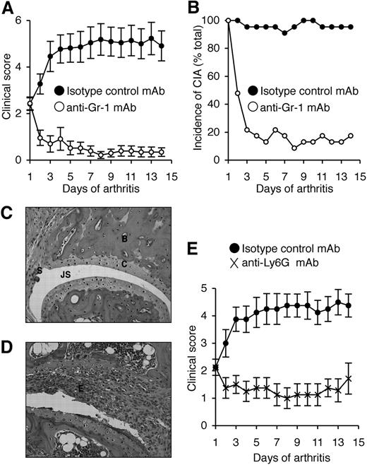 Figure 2. Neutrophil depletion attenuates established CIA. (A) Clinical scores (mean ± SEM) in WT DBA/1 mice treated with either isotype control mAb or anti–Gr-1 mAb after the onset of CIA. P < .001 during days 1 to 14 of arthritis. (B) Incidence of disease (percentage of total mice) in isotype control and anti–Gr-1 mAb-treated mice during 14 days of treatment. P < .001 at day 14. In panels A and B, n = 22 to 23 mice per treatment group; data pooled from 3 independent experiments. Histologic sections of typical joints from (C) anti–Gr-1 mAb and (D) isotype control mAb-treated mice. E indicates exudate; JS, joint space; C, cartilage; B, bone; and S, synovium. Magnification, ×200 (H&E stained). (E) Clinical scores (mean ± SEM) in WT DBA/1 mice treated with either isotype control mAb or anti-Ly6G mAb (1A8) after the onset of CIA. n = 8 mice per treatment group. P < .01 during days 1 to 14 of arthritis.