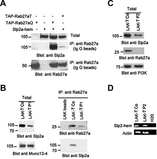Figure 4. The hematopoietic form of Slp2a interacts with Rab27a in transfected 293T cells and in primary T cells. (A) The TAP-active (TAP-Rab27aQ) or TAP-inactive form of Rab27a (TAP-Rab27aT) was cotransfected in 293T cells with the hematopoietic form of Slp2a. Cell lysates were immunoprecipitated with IgG beads. Coprecipitated Rab27a TAP mutants and Slp2a-hem were examined using immunoblot analysis with anti-Rab27a and anti-Slp2a. (B) Primary CTLs (LAK-T Co) from a control patient and a GS2 patient 1 (LAK-T P1) were lysed in the presence of phosphatase inhibitors. Cell lysates were immunoprecipitated with the beads alone (LAK-T beads) or with a monoclonal anti-Rab27a. The immunoblots were analyzed using anti-Rab27a, anti-Slp2a, and anti–Munc13-4. (C) Total cell lysates of primary CTLs from a control (Lak-T Co) and a GS2 patient with Rab27a nonsense mutation (Lak-T P2) analyzed by Western blotting. Blot was probed with anti-Rab27a and anti-Slp2a. Western blot analysis of PI3K was used as a loading control. (D) RT-PCR analysis of Slp2a-hem–specific transcript from a control and GS2 patient P2 (Lak-T P2). Actin expression was used for normalization.