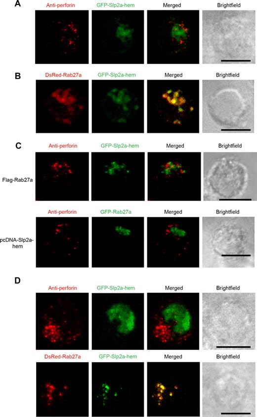 Figure 5. Slp2a-hem and Rab27a colocalize on the same vesicular structures, and the latter is distinct from perforin-containing granules. (A) Confocal microscopy of wild-type LAK-T cells transfected with GFP-Slp2a-hem and stained with a perforin monoclonal antibody (red). (B) Confocal microscopy of wild-type LAK-T cells transfected with GFP-Slp2a-hem and DsRed-Rab27a. (C) Confocal microscopy of wild-type LAK-T cells transfected with either GFP-Slp2a-hem and unlabeled Rab27a (top panel) or GFP-Rab27a and unlabeled Slp2a-hem (bottom panel). Fixed cells were then stained with an antiperforin (red). (D) Confocal microscopy of GS2 (Rab27a-deficient) LAK-T cells transfected with GFP-Slp2a-hem and labeled with an antiperforin (red) (top panel). Confocal microscopy of GS2 LAK-T cells cotransfected with GFP-Slp2a-hem and DsRed-Rab27a (bottom panel). Scale bars represent 5 μm. Data are representative of at least 4 independent experiments.