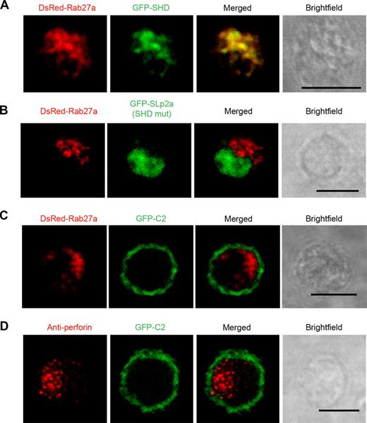 Figure 6. Slp2a recruitment on vesicular structures requires Rab27a. (A) Confocal microscopy of wild-type LAK-T cells transfected with GFP-Slp2a-SHD and DsRed-Rab27a. (B) Confocal microscopy of wild-type LAK-T cells transfected with GFP-Slp2a-SHDmut and Dsred-Rab27a. (C) Confocal microscopy of wild-type LAK-T cells transfected with GFP-Slp2a-C2 and DsRed-Rab27a. (D) Confocal microscopy of GS2 LAK-T cells transfected with GFP-Slp2a-C2 and labeled with an antiperforin (red). Scale bars represent 5 μm. Data are representative of at least 3 independent experiments.