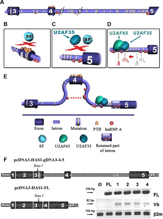 Figure 3. Bioinformatic model. Clusters of recurrent GVs facilitate aberrant splicing of HAS1 gene in patients with MM to create the intronic HAS1Vb splice variants. In this analysis we used the web-based bioinformatic tool ESE finder V2. Results were evaluated using ESE V3 (http://rulai.cshl.edu/cgi-bin/tools/ESE3/esefinder.cgi). For more detailed analysis we used ASD (The Alternative Splicing Database; workbench bioinformatics tools). Using these tools, we evaluated the distribution of splicing elements in HAS1 exons 3 and 4 and introns 3 and 4 of wild-type and mutated sequences. (A) Relative distribution of recurrent mutations detected in patients with MM and WM is shown, and the accumulation of 2 important splicing cofactors, hnRNP I (PTB) and hnTNP A, is shown in exon 4 and introns 3 and 4. (B-D) The location on the HAS1 gene where the aberrations occur. (E) Predicts the effect of recurrent GVs on HAS1 splicing. (D), The red letters “A” and “Y” represent activated splicing branch point (BP) and polypyrimidine tract (PPT) of splicing, respectively, and gray letters “A” and “Y” represent native BP and PPT. Description of the model. No differences were found between wild-type and mutated exon 3 with respect to the accumulation of hnRNPs which bind manly splicing suppressors and promote exon exclusion. However, in mutated exon 4, compared with wild-type exon 4 and in mutated exon 3, bioinformatic analysis predicted a massive accumulation of hnRNPs, including hnRNP I (PTB, polypyrimidine tract binding protein), which is distributed across the entire mutated exon 4 (A,B). As suggested in the diagram, the binding of PTBs at several sites of an exon could cause a loopout of this exon, and subsequently these types of exons become inaccessible for the assembly of the spliceosome (B,C,E). The analysis did not predict any significant differences between wild-type and mutated intron 3 with respect to Serin/Arginine-rich proteins (SRs) or the distribution of hnRNP binding motifs. In addition, no significant difference was found when BP and PPT were mapped on wild-type and mutated intron 3. However, for mutated intron 4, the existence of alternative splicing branch points were predicted. These alternative BPs are located upstream of the alternative PPT (D). In addition, splicing element analysis of wild-type and mutated intron 4 showed an accumulation of a significant number of SR and hnRNP binding motifs in mutated intron 4. Among them, the most significant predicted difference that contributes to intronic splicing of HAS1 is recruitment of U2AF65 protein by the alternative PPTs (D). These predicted PPT sequences overlap with the 1st and 2nd “T” stretches and TTTA repeats of mutated intron 4 (the common motif) where the MM clusters of GVs are located. The protein U2SF65 is known to be responsible for the recruitment of SFs to splicing BP. Subsequently, this protein acts as a “bridge” between BP and PPT and stabilizes the spliceosomal complex necessary for the first stage of the splicing reaction. In addition, our analysis of wild-type and mutated intron 4 predicted the loss of a significant number of binding motifs for hnRNP proteins from mutated intron 4 compared with wild type. However, mutated intron 4 maintained ability to recruit hnRNP, a protein which most likely contributes to the exclusion of exon 4 through its ability to dimerise with other molecules of hnRNP A located within and on adjacent introns (E). (F) Splicing of aberrant HAS1 Vb transcripts in transfected HeLa cells. The diagram shows the expression cassettes for HAS1 minigene constructs. HAS1 sequences were flanked by a mammalian CMV promoter at the 5′ end of HAS1 gene and the bovine growth hormone polyadenylation signal, poly A, at the 3′ end. mRNA splicing was analyzed by transfecting HeLa cells with HAS1 minigene cassettes. RT-PCR was performed 24 hours after transfection, using specific primers for HAS1 full-length (FL), HAS1Vb or B2m (β-2 microglobulin). On the gel, Ø indicates the result obtained from the cells transfected with cassette without HAS1 gene; FL, the result obtained from the cells transfected with pcDNA3-HAS1-FL cDNA construct, which is already spliced; Lanes 1 to 4 represent Hela cells transfected with pcDNA3-HAS1-g3–4-5 construct. We tested 4 subclones of the HAS1 minigene cassette; transfection of all 4 subclones gave identical results. Product identity was confirmed by sequencing. For this experiment, Ø and FL were used as controls to verify specificity of the in vitro splicing assay.