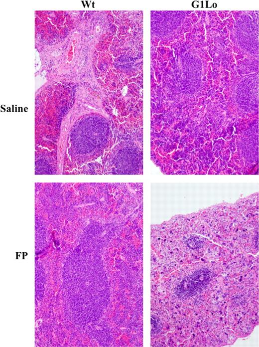 Figure 6. Splenic disruption by megakaryoblastic proliferative disorder. After treatment for 9 days with 5 mg/kg per day of intraperitoneal flavopiridol, mice were killed for histologic analysis of spleens. Comparisons include C57BL/6 (Wt) and GATA-1Lo (G1Lo) strains treated either with saline or flavopiridol (FP). Shown are representative hematoxylin and eosin–stained splenic sections (original magnification ×100).