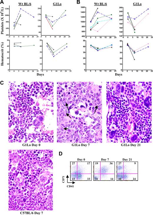 Figure 7. Reversibility of the megakaryoblastic proliferative disorder. (A-D) C57BL/6 and GATA-1Lo (G1Lo) mice received daily intraperitoneal injection of flavopiridol (7 mg/kg per day) for 7 consecutive days, followed by 2 weeks of no treatment. (A,B) Platelet counts and hematocrits were obtained on days 0, 7, and 21 as indicated. Each line represents an individual mouse. (A,B) Two independent experimental trials. (C) Representative mice were killed at days 0, 7, and 21. Sections from femurs were stained with hematoxylin and eosin (original magnification ×400). Arrows show examples of cells with blastic morphology. (D) Flow cytometry on marrows from mice in panel C.