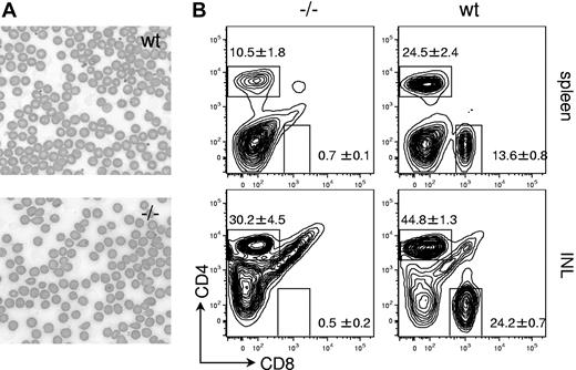 Figure 2. Erythrocyte abnormalities and peripheral lymphopenia in Gimap5−/− mice. (A) Peripheral blood smear (Wright-Giemsa stain, original magnification ×400). Bars represent 10 μm. wt indicates wild-type; −/−, Gimap5-knockout. Images were acquired on a Nikon Eclipse E600 microscope with 10×, 20×, and 40× PlanFluor objectives and a SPOT Insight 11.2 color mosaic digital camera with Spot software version 4.1 (Diagnostic Instruments, Sterling Heights, MI). (B) Representative FACS analysis of wild-type (wt) and Gimap5-deficient (−/−) splenocytes and inguinal lymph node cells (INL) for expression of CD8 and CD4. Boxes indicate gates used to calculate frequencies presented in Table 1. Gimap5−/− mice exhibit peripheral lymphopenia, with reduced abundance of CD4 T cells and almost complete absence of CD8 T cells from the spleen and inguinal lymph nodes (INL).