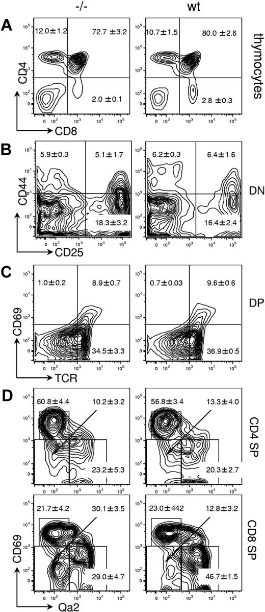 Figure 4. Thymic development in Gimap5−/− mice. Representative FACS plots of wild-type (wt) or Gimap5-deficient (−/−) thymocytes. (A) Expression of CD4 and CD8 in unfractionated thymocytes. Boxes indicate gates used to calculate the average frequencies included in the text. (B) Expression of CD44 and CD25 in DN thymocytes contained in the DN gate of panel A. (C) Expression of CD69 and H57/TCR-β (TCR) in DP thymocytes contained in the DP gate of panel A. (D) Expression of CD69 and Qa2 in CD4SP and CD8SP thymocytes. The relative accumulation of CD69LOWQa2− versus CD69LOWQa2+ cells indicates a defect in the final stages of intrathymic T-cell maturation in Gimap5−/− mice.