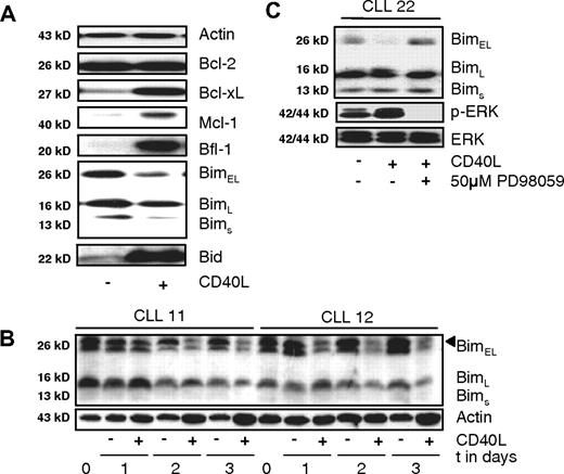Figure 1. Antiapoptotic changes in CLL cells upon CD40 stimulation include ERK-mediated decrease in Bim levels. (A) Changes in expression of apoptosis regulators upon 48 hours of CD40 triggering were monitored by Western blot for the indicated proteins. Results are from a representative CLL sample from more than 10 patients studied. Equal protein loading was confirmed by staining for actin as loading control. (B) Time course of Bim-EL decrease monitored in 2 CLL samples. Shown are samples taken on consecutive days of coculture in absence or presence of CD40 stimulation. In sample 11 a decrease in Bim-EL can be observed on day 2, and in sample 12 on day 1. Position of Bim-EL is indicated by a triangle, the faster migrating species is probably the Bimα1 splice variant. (C) Effects of ERK inhibition on Bim levels and phosphorylated ERK. CLL cells were stimulated with CD40 in the presence of ERK inhibitor as indicated, and lysates were probed for Bim protein, phosphorylated and total ERK levels.