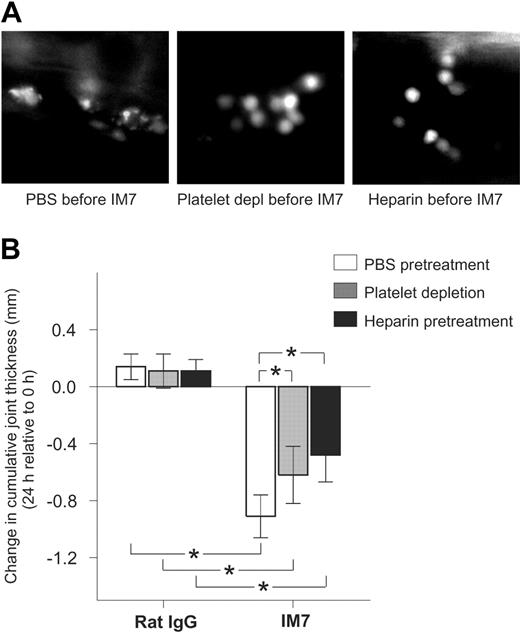 Figure 6. Inhibition of platelet deposition on leukocytes by administration of platelet-depleting antibodies or heparin reduces the anti-inflammatory effect of IM7 treatment in PGIA. (A) Deposition of platelets, seen as bright particles on leukocyte surfaces, in the synovial venule of a mouse pretreated with PBS (left) before IM7 injection, is inhibited in animals that received platelet-depleting pAb (middle) or heparin (right) 25 minutes before IM7 administration. (B) In control rat IgG-injected arthritic mice, platelet-depleting antibodies (▩) and heparin (■) do not have an effect on the 24-hour progression of joint swelling compared with PBS (□), but both platelet depletion and heparin significantly reduce the therapeutic effect (ie, suppression of joint swelling) of IM7. Mice were injected with PBS or received platelet-depleting pAb (100 μg) or heparin (40 U) 25 minutes before administration of rat IgG or IM7 (200 μg each). Joint thickness was measured at 0 and 24 hours. Results are expressed as changes (in mm) in cumulative (sum of 4 paws) joint thickness in 24 hours (n = 6 mice/group; *P < .05).