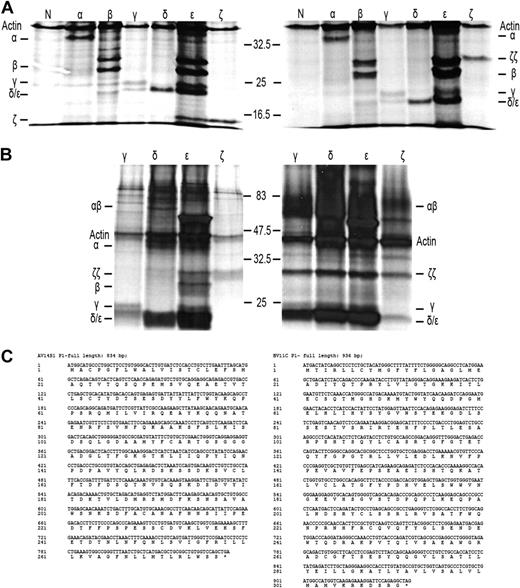 Figure 3. Defective association of the TCR chains underlies the loss of surface TCR-CD3 expression in RCD cell line P1. SDS-PAGE analysis of immunoprecipitates of RCD cell line P1 and T-cell clone N10 after 35S metabolic labeling. Antisera used were normal rabbit serum as negative control (N), anti–TCR-α (α), anti–TCR-β (β), anti-CD3γ (γ), anti-CD3δ (δ), anti-CD3ϵ (ϵ), and anti-ζ (ζ). (A) Immunoprecipitates obtained from NP40 lysates of RCD cell line P1 were analyzed under reducing (left) and nonreducing (right) conditions. (B) Immunoprecipitates obtained from digitonin lysates of RCD cell line P1 (left) and T-cell clone N10 (right) were analyzed under nonreducing conditions. Positions of individual chains and molecular mass markers (kilodaltons) are indicated. (C) Sequences of the TCR-α and TCR-β chain of cell line P1 (TCRAV14S1, TCRBV11c).