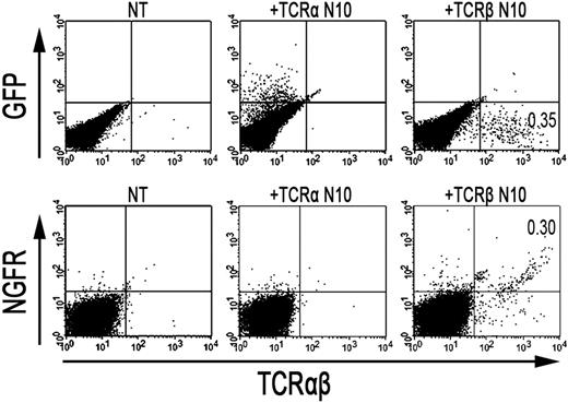 Figure 4. Retroviral introduction of exogenous TCR-β chains in RCD cell line P1 restores surface TCR-αβ expression. FACS analysis after retroviral transduction of cells from RCD cell line P1 with the TCR-α or TCR-β chain from T-cell clone N10. (Top panel) GFP- (TCR-α from N10) and TCR-αβ expression on nontransduced P1 cells (NT), P1 cells transduced with the TCR-α chain from T-cell clone N10 (+TCR-α N10), and on P1 cells transduced with the TCR-β chain from T-cell clone N10 (+TCR-β N10). (Bottom panel) NGFR- (TCR-β from N10) and TCR-αβ expression, also on nontransduced P1 cells (NT), P1 cells transduced with the TCR-α chain from T-cell clone N10 (+TCR-α N10), and on P1 cells transduced with the TCR-β chain from T-cell clone N10 (+TCR-β N10).