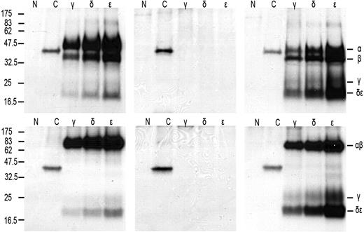 Figure 5. Retroviral introduction of exogenous TCR-β chains in RCD cell line P1 restores TCR-αβ dimer formation and surface expression. SDS-PAGE analysis of immunoprecipitates obtained from digitonin lysates of T-cell clone N10 (left), RCD cell line P1 (middle), and RCD cell line P1 transduced with TCR-β from N10 (right) after cell surface iodination. Antisera used were normal rabbit serum as negative control (N), anti-HLA class I (C), anti-CD3γ (γ), anti-CD3δ (δ), and anti-CD3ϵ (ϵ). (Top panel) Reducing conditions. (Bottom panel) Nonreducing conditions. Positions of individual chains and molecular mass markers (kilodaltons) are indicated.