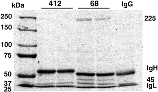 Figure 1. CLL mAb with stereotypic IGHV1-69, IGHD3-16, and IGHJ3 rearrangements immunoprecipitate observable proteins. A total of 6% SDS-PAGE of immunoprecipitate from HEp-2 cell extracts treated with mAb having stereotypic IGHV1-69, IGHD3-16, and IGHJ3 rearrangements (CLL068, 2 different recombinant mAb preparations) or not (CLL412, 2 different recombinant mAb preparations, or IgG) is shown with protein size (kilodalton) markers. Another mAb having stereotypic IGHV1-69, IGHD3-16, and IGHJ3 rearrangements (CLL258) showed similar results (Figure S1). mAb heavy chain (IgH) and light chain (IgL) as well as 225- and 45-kDa protein bands are indicated.
