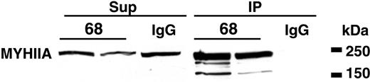 Figure 3. CLL mAb with stereotypic IGHV1-69, IGHD3-16, and IGHJ3 rearrangements immunoprecipitate MYHIIA. Antibodies from CLL068 (2 different recombinant mAb preparations) or human IgG were used to immunoprecipitate HEp-2 cell extracts. Immunoprecipitate (IP) and supernatant (Sup) samples were electrophoresed in 6% SDS-PAGE as in Figure 1. After blotting to nitrocellulose, the membrane was probed with rabbit antihuman anti-MYHIIA as shown.