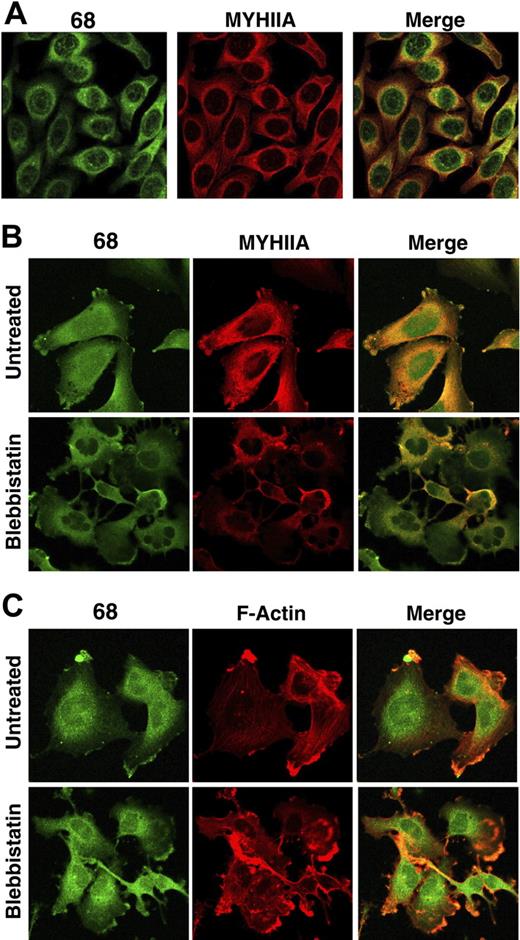 Figure 4. Binding of CLL mAb with stereotypic IGHV1-69, IGHD3-16, and IGHJ3 rearrangements colocalizes with MYHIIA. (A) HEp-2 cells stained with CLL068 antibody (green) and anti-MYHIIA antibody (red) were visualized by confocal microscopy separately and merged together (overlap in yellowish orange). Untreated or blebbistatin-treated SNB19 cells were stained with CLL068 antibody (green) and (B) anti-MYHIIA antibody (red) or (C) phalloidin-stained F-actin (red). Cells were visualized by confocal microscopy separately and merged together.
