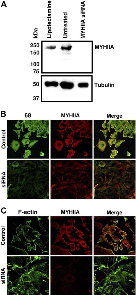 Figure 5. MYHIIA siRNA treatment removes most cellular staining by CLL mAb with stereotypic IGHV1-69, IGHD3-16, and IGHJ3 rearrangements. (A) Immunoblot of SNB19 cell extracts either untreated or after transfection with MYHIIA siRNA or Lipofectamine 2000 alone. Top part of membrane containing high MW proteins (> 75 kDa) was probed with anti-MYHIIA, and the lower part with low MW proteins was probed with anti-alpha-tubulin. MYHIIA siRNA reduced MYHIIA protein levels by 99.6% relative to Lipofectamine 2000 alone. Lipofectamine 2000 alone (Control) or siRNA-transfected SNB19 cells were stained with CLL068 antibody (green) and (B) anti-MYHIIA antibody (red) or (C) phalloidin stained F-actin (red). Cells were visualized by confocal microscopy separately and merged together.