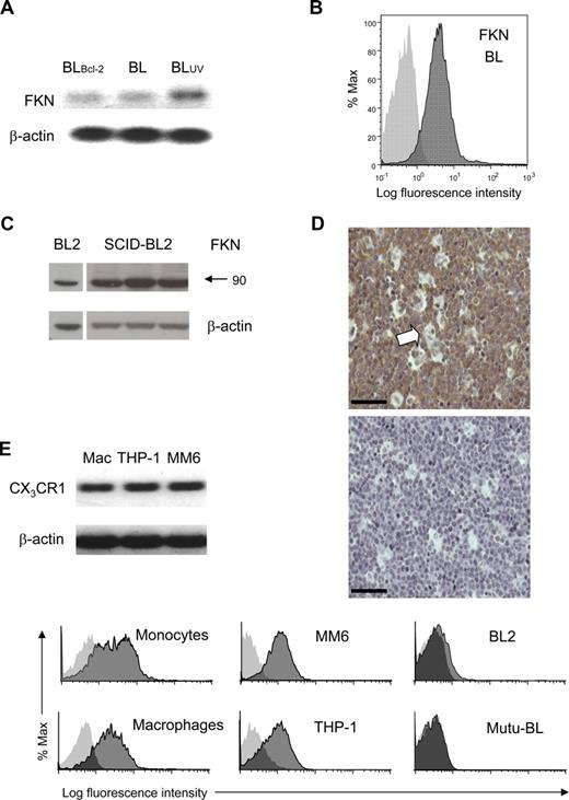 Figure 2. Expression of FKN and its cognate receptor by BL cells vs mononuclear phagocytes. (A) FKN RT-PCR products amplified from Mutu-BL cells (BL), Bcl-2 transfectants (BLBcl-2), and UV-induced Mutu-BL cells (BLUV). β-actin products are shown for comparison. (B) Expression of FKN on the surface of BL cells. BL2 cells were labeled by indirect immunofluorescence using anti-FKN mAb (clone 81513). Flow cytometric histograms of surface FKN (dark gray) compared with background immunostaining (light gray) are shown. (C) Immunoblots showing FKN expression in lysates of BL2 cell lines and BL tumors. SDS-PAGE (30 μg of protein per lane) was performed on lysates from BL2 cells (left panels) and 3 separate BL2 tumors grown in SCID mice (right panels). Proteins were transferred to Hybond P membrane and immunoblotted using anti-FKN antibody (clone 81513). Blots were stripped and reprobed for β-actin to check for loading variability. (D) Expression of FKN in tumor tissue in situ. Immunohistochemical staining was performed on archive paraffin sections of BL tumor tissue. Diaminobenzidine (DAB) chromogen product (brown) represents FKN staining (hematoxylin counterstain). Primary anti-FKN mAb (clone 81513, top panel); isotype control mAb (mouse IgG1, bottom panel). Arrow indicates example of starry-sky macrophage. Bar represents 52 μm. Stained tissue was analyzed using a Zeiss Axioskop 2 microscope (Zeiss, Welwyn Garden City, United Kingdom) at 20°C with objective lens Plan-NEOFLUAR 20× (numerical aperture 0.50) and histomount medium (Raymond A. Lamb, Eastbourne, United Kingdom), and images were taken using Jenoptik ProgRes C14 camera (Jenoptik, Jena, Germany) with Openlab 4.0.2 software (Improvision/PerkinElmer, Coventry, United Kingdom). (E) FKN receptor, CX3CR1 RT-PCR products amplified from HMDM (Mac), and the monocyte/macrophage cell lines THP-1 and MonoMac6 (MM6). β-actin products are shown for comparison. (F) Expression of FKN receptor, CX3CR1 on the surface of human monocytes, macrophages, and monocyte/macrophage cell lines THP-1 and MM6 but not BL cells (BL2 and Mutu-BL). Viable cells were labeled by indirect immunofluorescence using anti-CX3CR1 polyclonal antibody primary and PE-conjugated secondary. Flow cytometric histograms of surface FKN (dark gray) compared with background immunostaining (light gray) are shown.