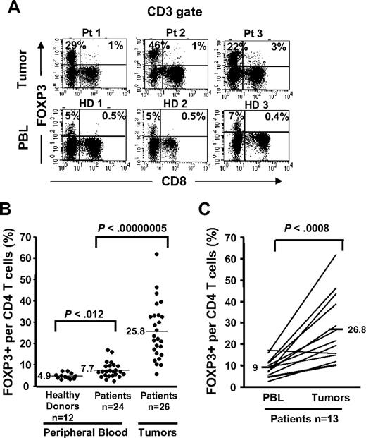 Figure 1. Selective accumulation of FOXP3+CD4 T cells in tumors compared with PBLs. Cryopreserved tumor digests from 3 patients with metastatic melanoma (Pt) and PBLs from 3 healthy donors (HD) were thawed and immediately stained with CD3, CD8, and FOXP3 mAbs. (A) The dotplots were gated on CD3+ lymphocytes. The quadrants were set based on the isotype control Abs. The percentage for each quadrant represents the fraction of FOXP3+ T cells in CD8 T cells (top right quadrant) or in CD4 T cells (top left quadrant). CD3+CD8− T cells were considered CD4 T cells throughout the study. (B) The percentage of FOXP3+CD4 T cells per total CD4 T-cell population is quantified in PBLs from healthy donors (n = 12) and from patients with melanoma (n = 24) and in tumor digests (n = 26) using FACS analyses. (C) The percentage of FOXP3+CD4 T cells per total CD4 T cells in PBLs and tumors from the same patients (n = 13) were enumerated as described earlier.